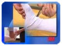 Soft Cast: Ankle Wrap Application & Removal